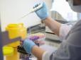 Хворих може бути більше? Україна очолила сумний рейтинг з тестування на коронавірус