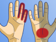 Слідкуйте за своїми долонями! ТОП-7 хвороб, про які попереджають наші руки