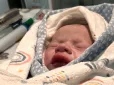 Життя переможе! Жителька Рівненщини з хворобою серця народила дитину під час обстрілів у Києві